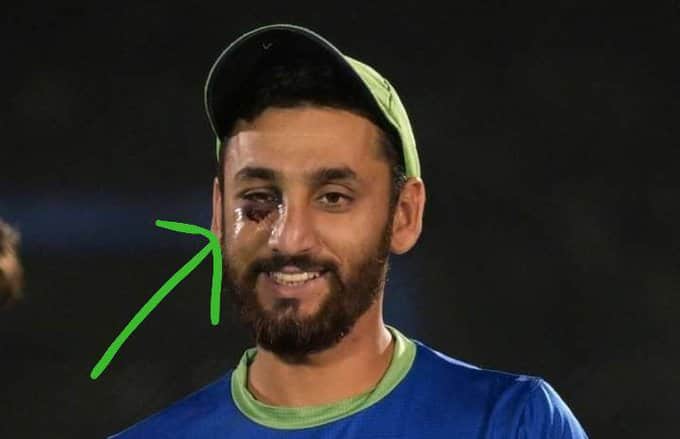 Pakistan Cricketer Agha Salman's Scary Picture Surfaces After Being Hit On Face vs India