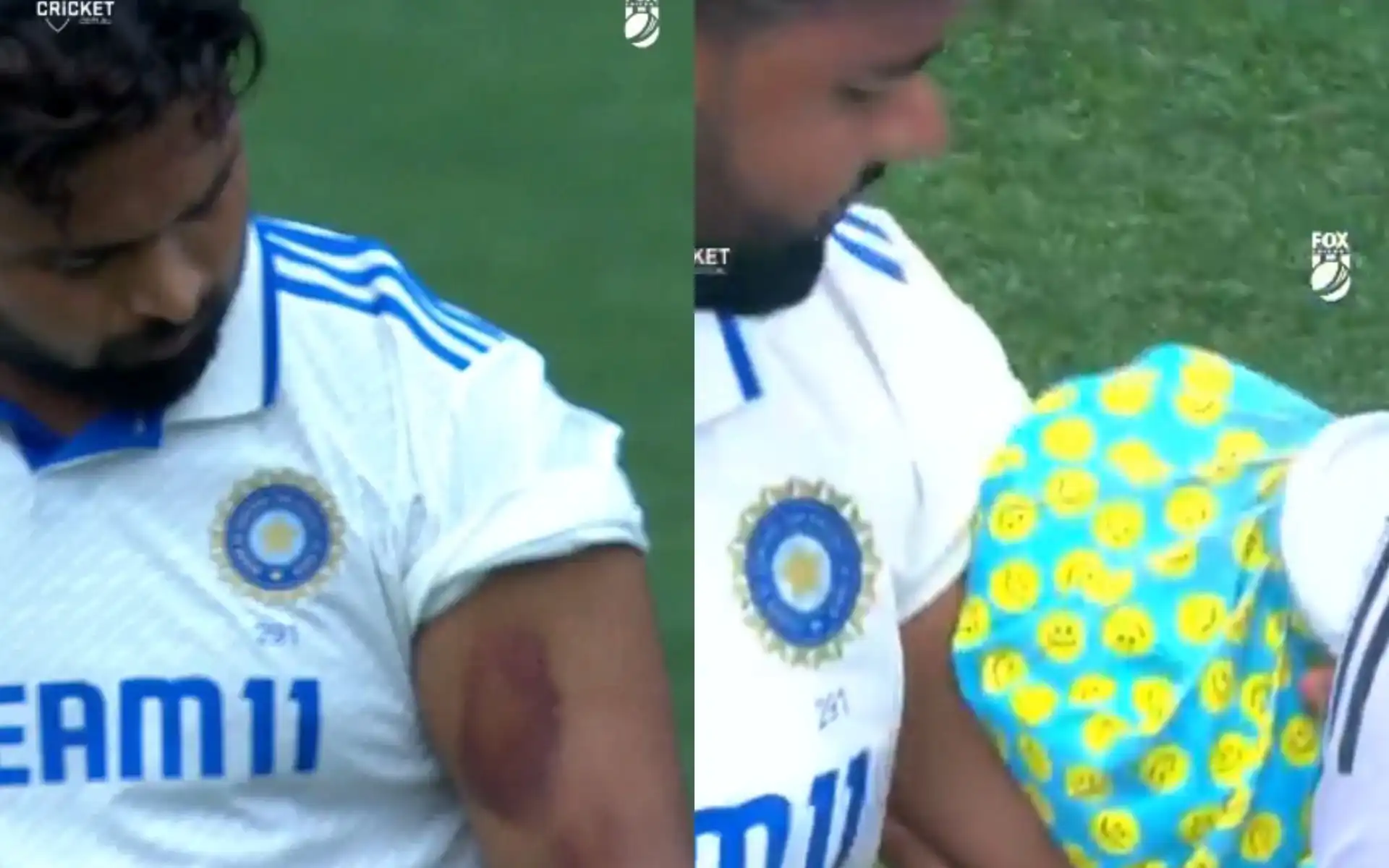 Pant's Injury (Source: @21OneTwo34/x.com, @iseup_pant17/x.com)