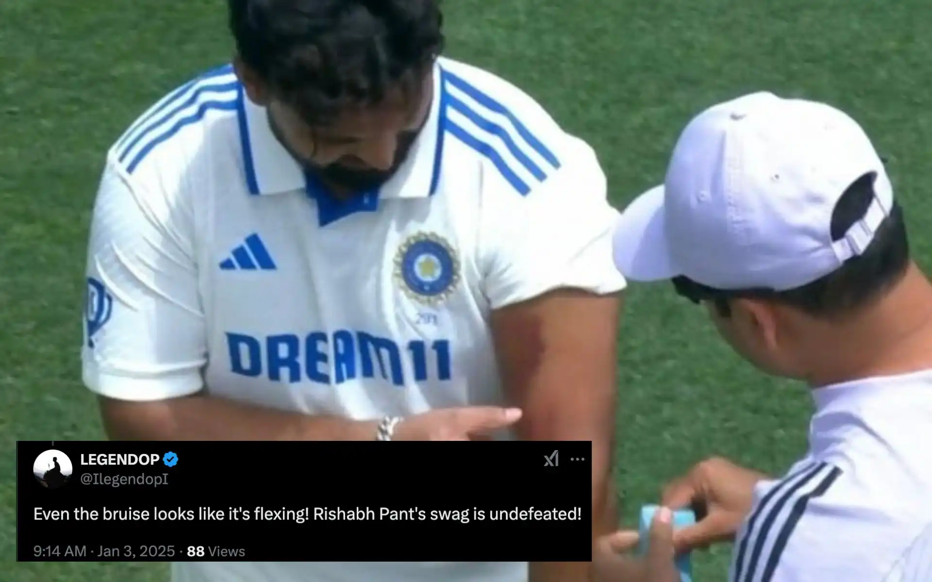 'Fighter, Bruised But Unshaken...': Netizens Full Of Praise For Rishabh Pant After Gritty Show