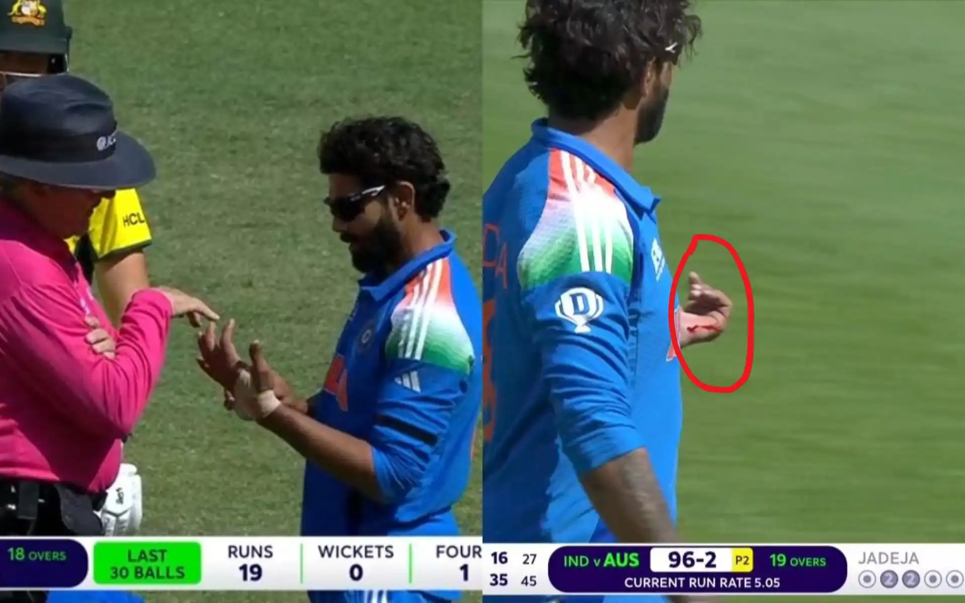 Ravindra Jadeja bleeding after removing his tape in IND vs AUS CT match [Source: @MemesWorld4u, @we_knowd/x.com]
