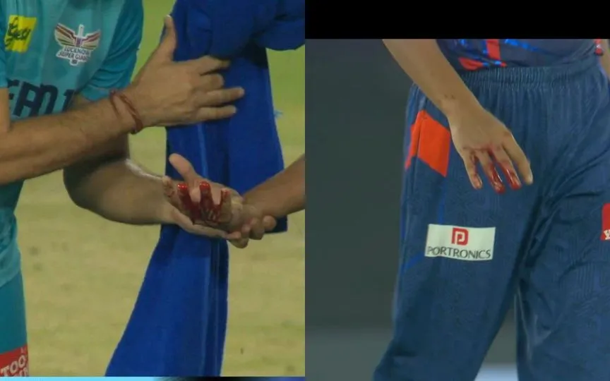 Akash Singh's hand bleeding after hit by Gill's shot [Source: OneCricketApp/x.com]