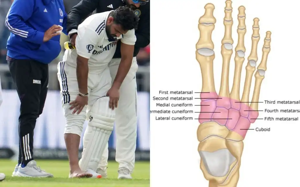 Rishabh Pant injury type [Source: AP Photos, @OBandarchi/x.com]