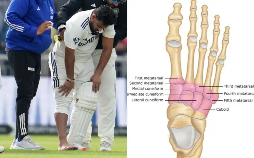 Metatarsal Fracture For Pant: What Is The Nature Of India Star's Injury? Recovery Details