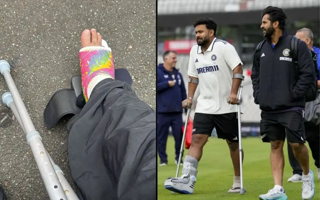 Pant shares photo of his leg [Source: Instagram/Rishabh Pant]

