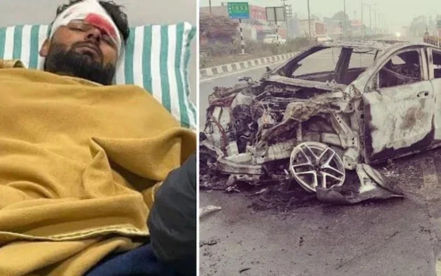 Rishabh Pant's Multiple Ligament Tears - 2022 (Source:@vaibhavUP65,x.com)