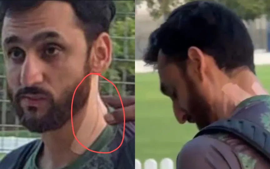 Bandaged Neck, Out Of Practice Session: Agha Salman's Injury Concerns Pakistan In Asia Cup