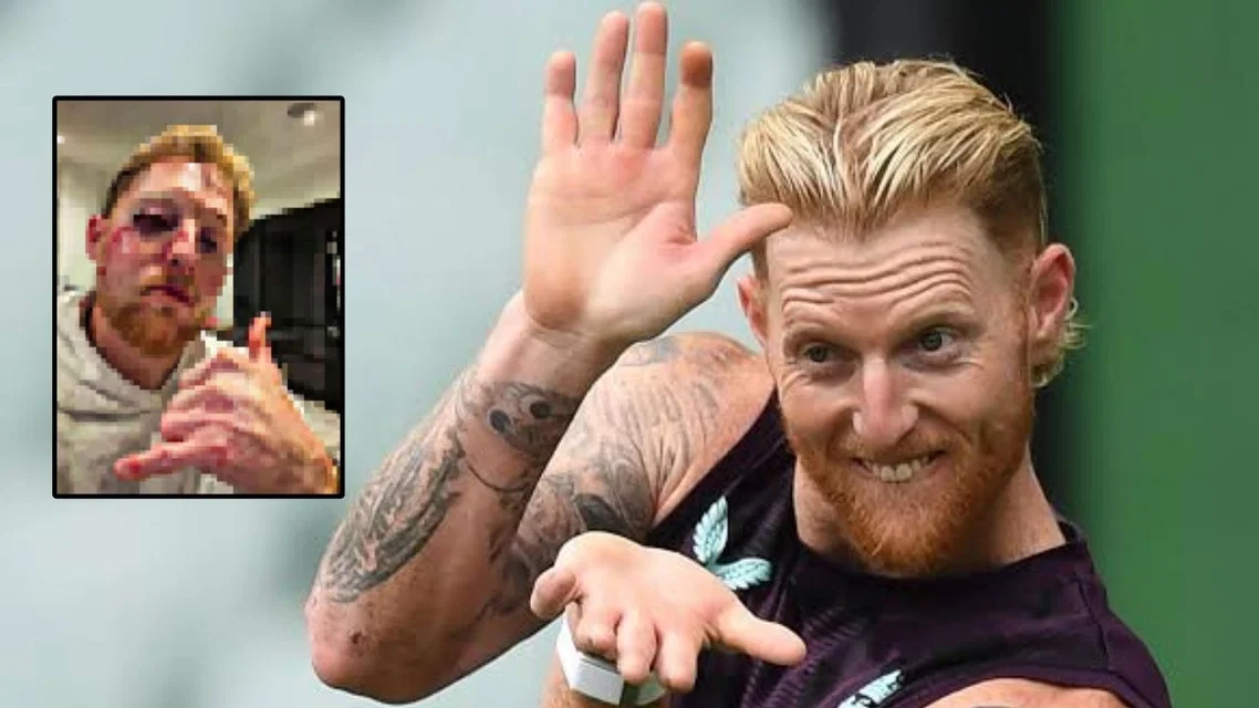 Ben Stokes shares bloody and gory selfie on Instagram [Source: Instagram]
