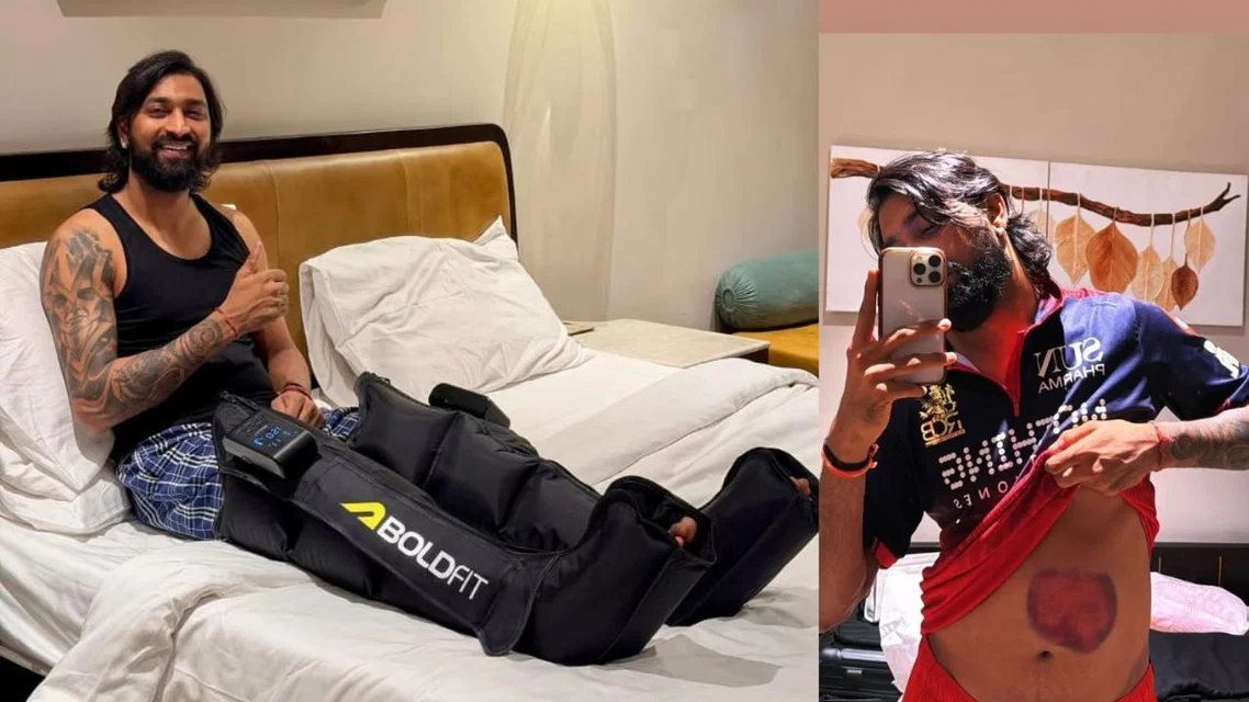 Krunal Pandya injury (Source: Instagram)