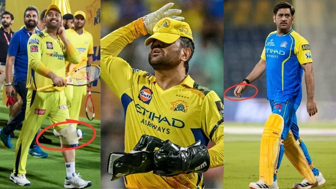 MS Dhoni injuries in IPL 2026 (Source: X.com & AFP)
