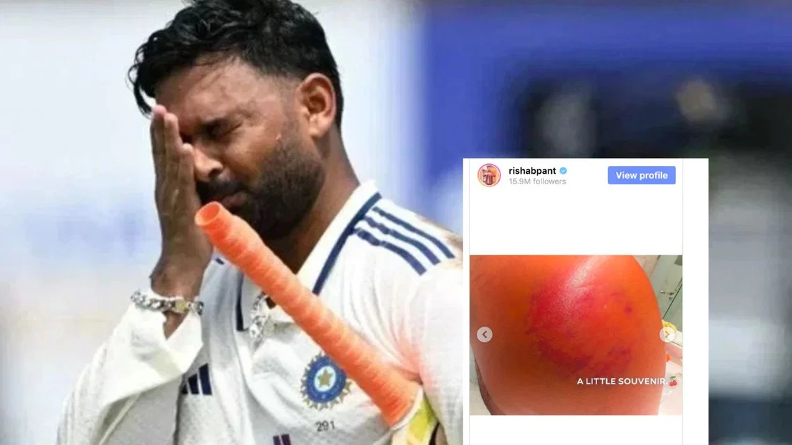 Rishabh Pant opens up about his injury vs SL [Source: AFP]