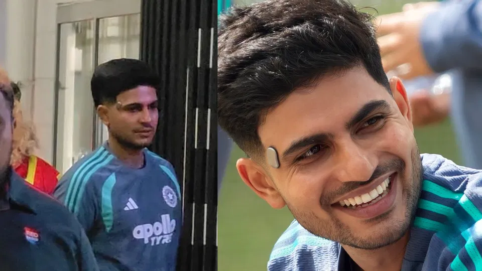 Shubman Gill Spotted With Mysterious Temple Device In New Zealand, Here’s What It Does